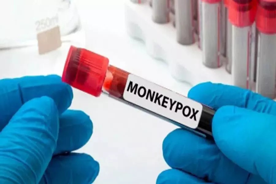 Monkeypox cases in india, भारत में मंकीपॉक्स से पहली मौत की हुई पुष्टि, | News