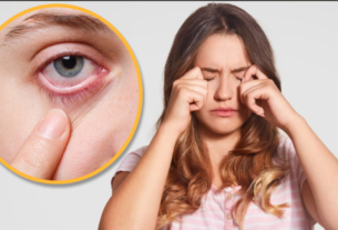 itching in eyes, eyes diseases, Health News, eye infection, red eye, red eye infection, how to remove red eye, eye infection in hindi, allergy , Dull Eyes, eyes, Eyes caring tips, Eyes Swollen home remedies, health care tips in Hindi,