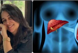 #DipikaKakar, #LiverTumor, #HealthAwareness, #CancerAwareness, #SymptomsToWatch, #StayInformed, #HealthTips, #PreventiveCare, #SupportForSurvivors, #WellnessJourney,