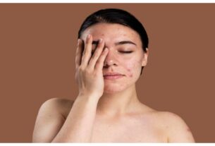 Reason Behind Dry Skin: Does your skin also remain dry? Know the reasons and remedies behind it