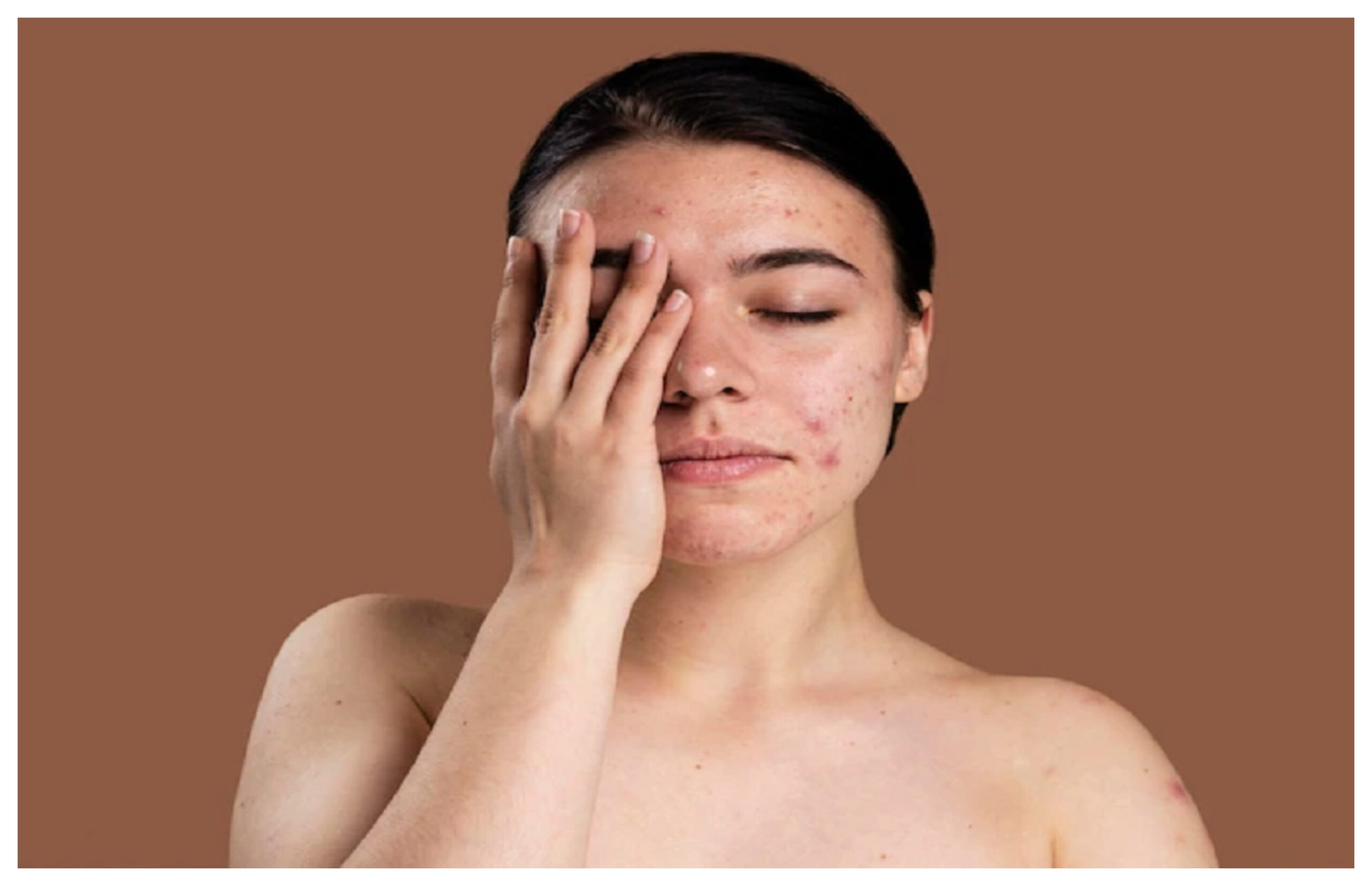 Reason Behind Dry Skin: Does your skin also remain dry? Know the reasons and remedies behind it