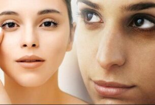 Tips To Remove Dark Circles, "tips to remove dark circles, chehra chamkane ke liye kya kare, how to get glowing skin, home remedies for clear skin