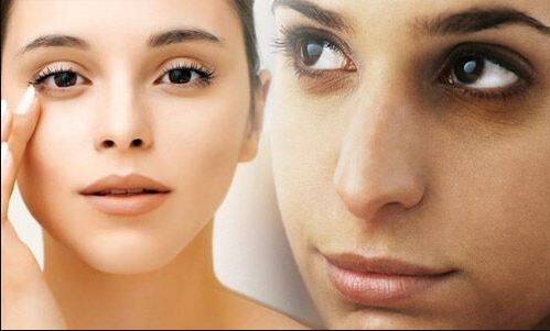 Tips To Remove Dark Circles, "tips to remove dark circles, chehra chamkane ke liye kya kare, how to get glowing skin, home remedies for clear skin